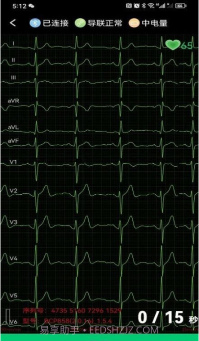 心电一张网截图2 心电一张网截图2