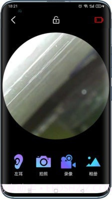 可视采耳仪截图3