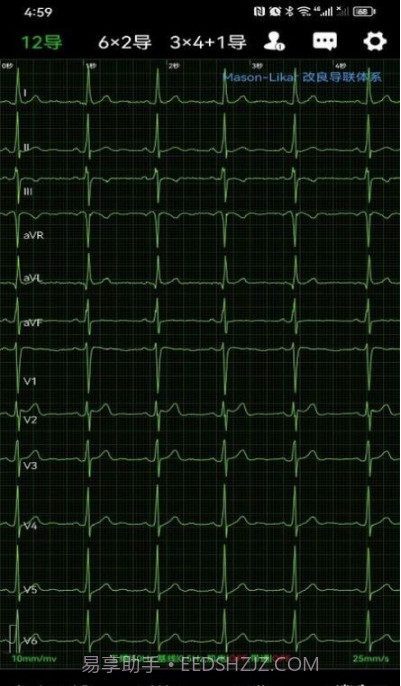 心电一张网截图4 心电一张网截图4