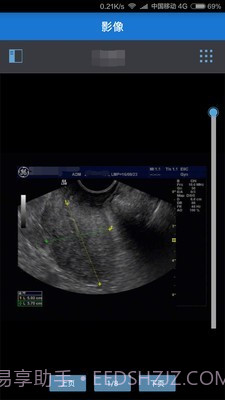 健康格子截图2 健康格子截图2