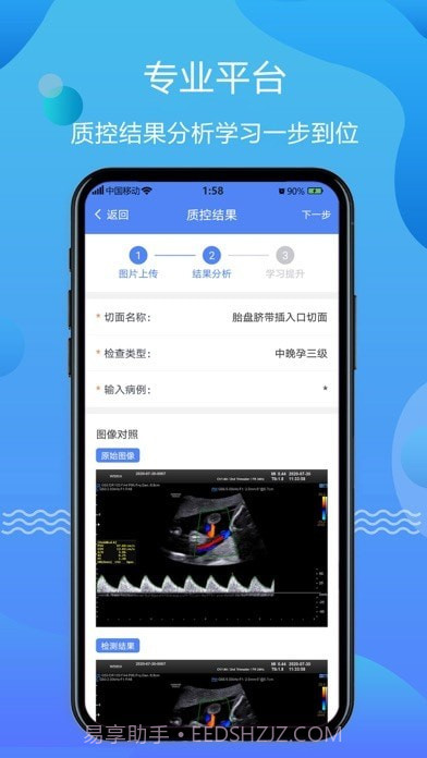 超声智库截图3