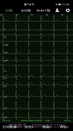 爱心电截图2 爱心电截图2