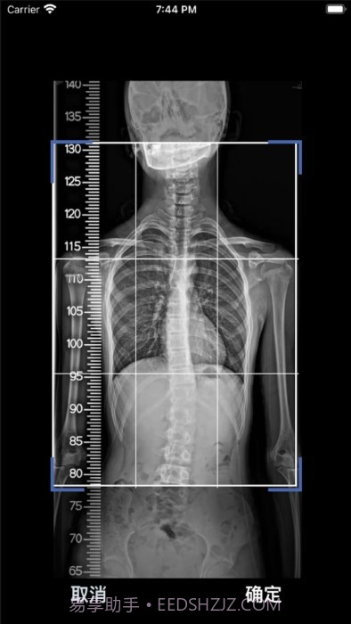 cobb角测量分析平台截图1