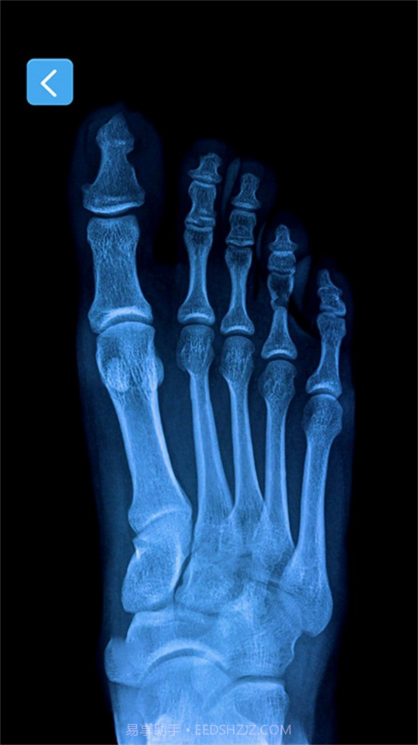 X射线模拟器截图2