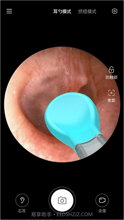 Xlife掏耳勺截图3
